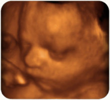 Ultraschalluntersuchungen in der Schwangerschaft